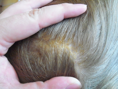 Cubelixa�s Hairy Journey August 2012