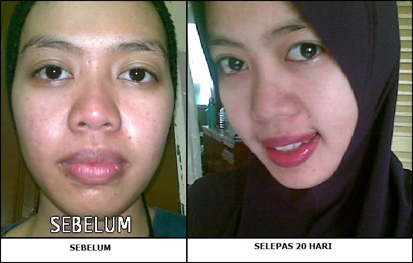 Ct Hajar Kedai Baju: AURA MAYA SKIN CARE