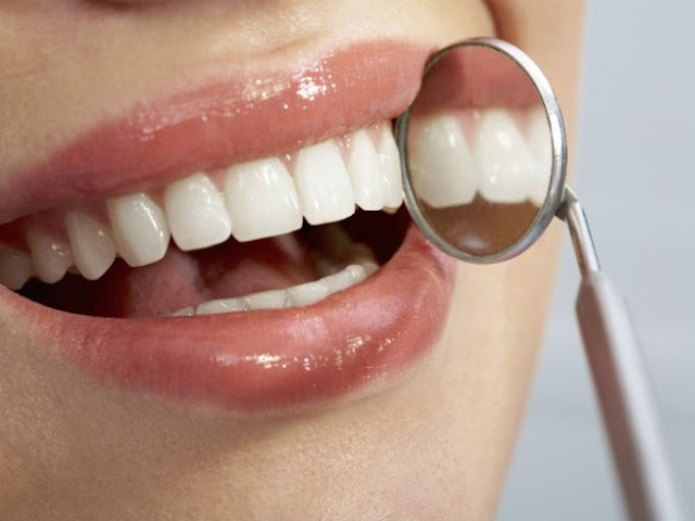 Hablemos de salud.: Cuida tus dientes del Sarro.