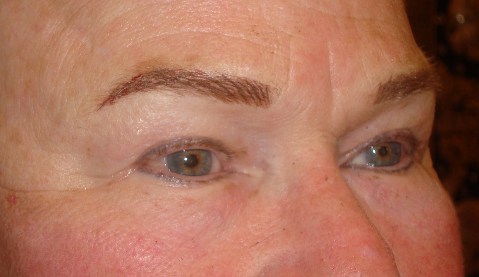 Permanent Makeup Beauty Scars on my eyebrows