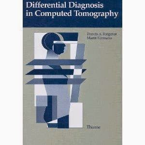 download neurological differential diagnosis by john patten