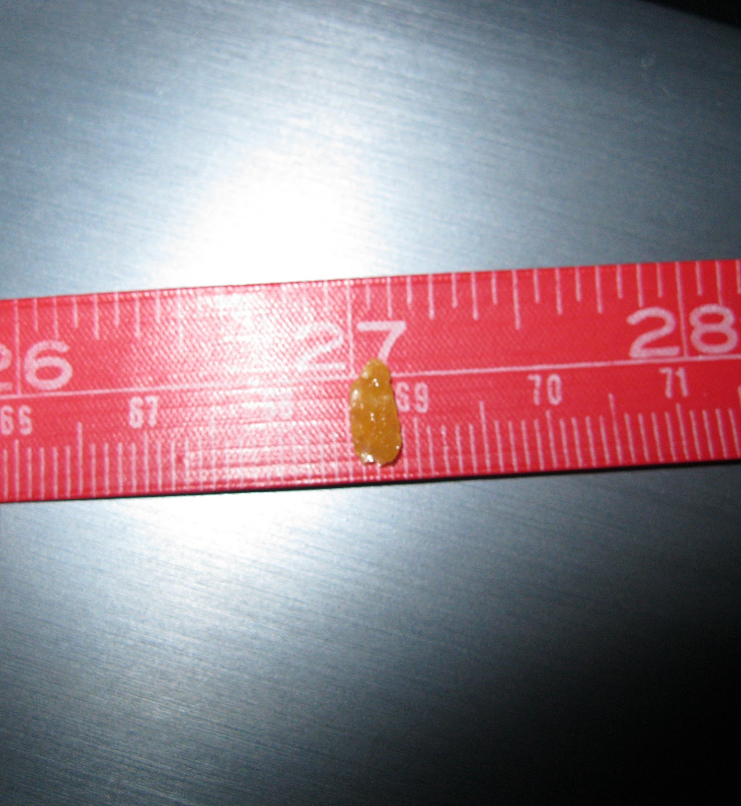 Ultimate flora probiotic 25 billion, do probiotics help with