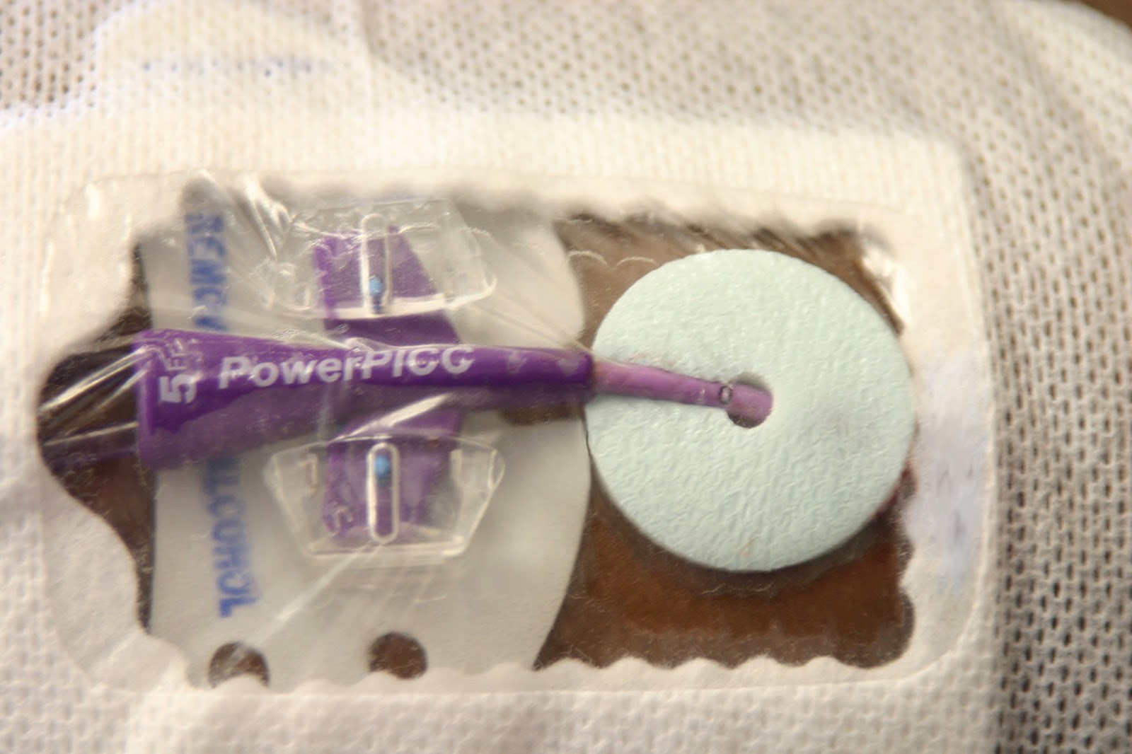 vox médica dr. gonzalo bearman Chlorhexidine Impregnated Dressings