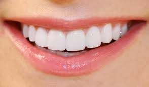 http://www.dentistinchennai.com/teeth-whitening-or-bleaching.php