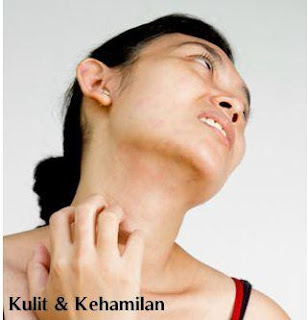 8 tips atasi masalah kulit pada ibu hamil info kesehatan 8 tips atasi masalah kulit pada ibu hamil info kesehatan