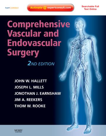 Comprehensive Vascular and Endovascular Surgery , 2nd Edition 