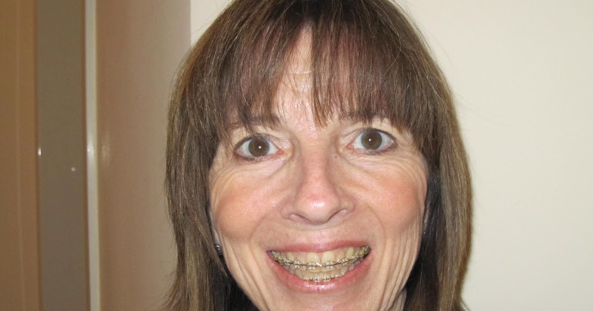 Picketts in Poland Braces...