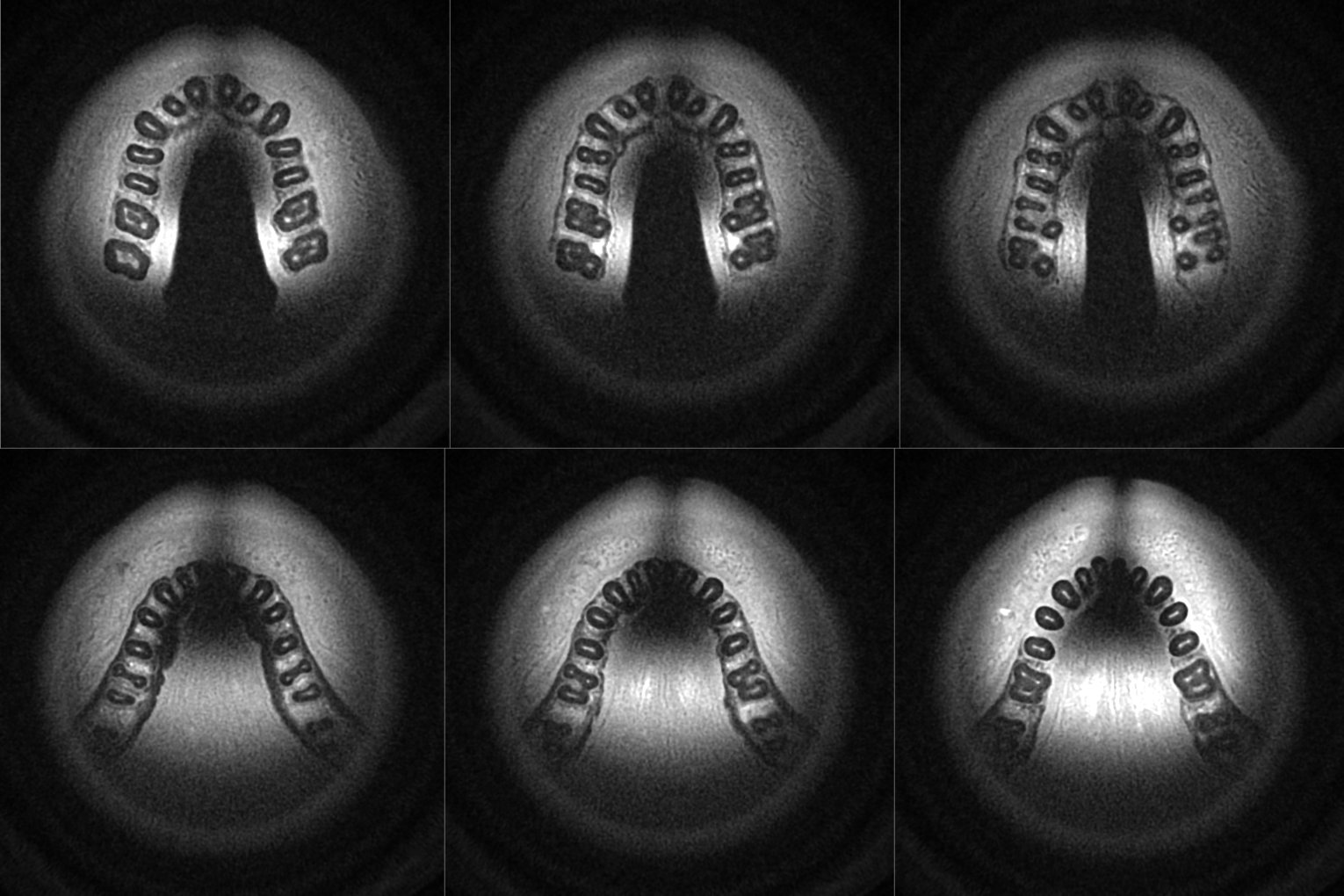 MRI and Medical Imaging New dental MRI study yields best images yet