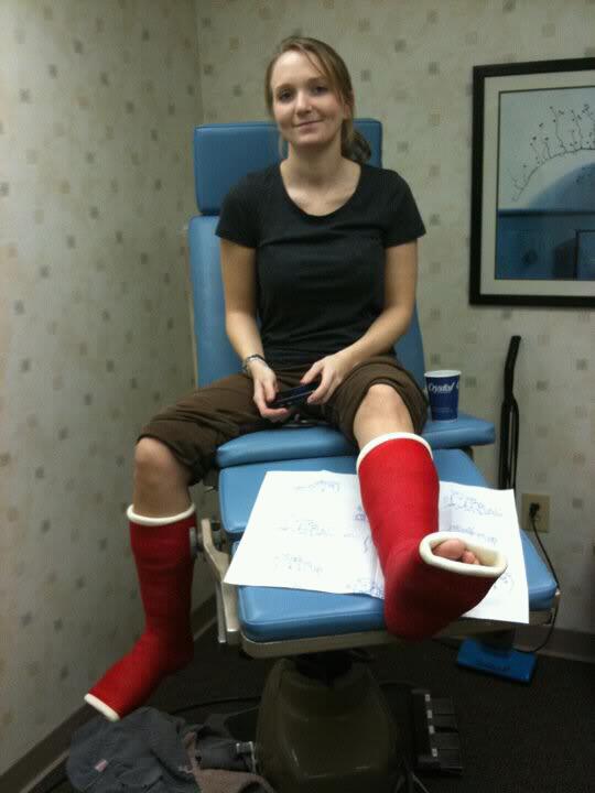 Eco cast the attraction to orthopedic casts