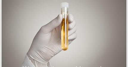 Pengobatan Tradisional Anuria Yang Ampuh | Ramuan Obat Tradisional Gagal Ginjal Terbaik