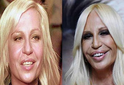plastic surgery and celebrities