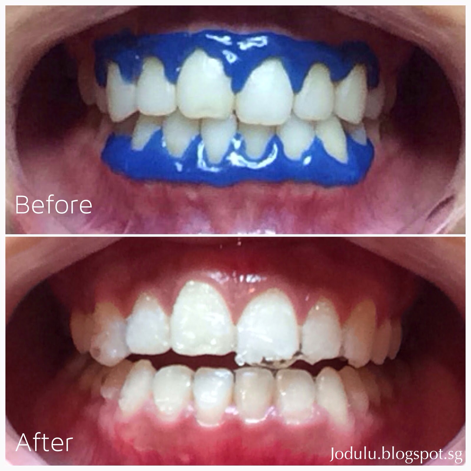 Jodulu The Mermaid Lifestyle & Beauty Blog Lush Aesthetics LED Teeth