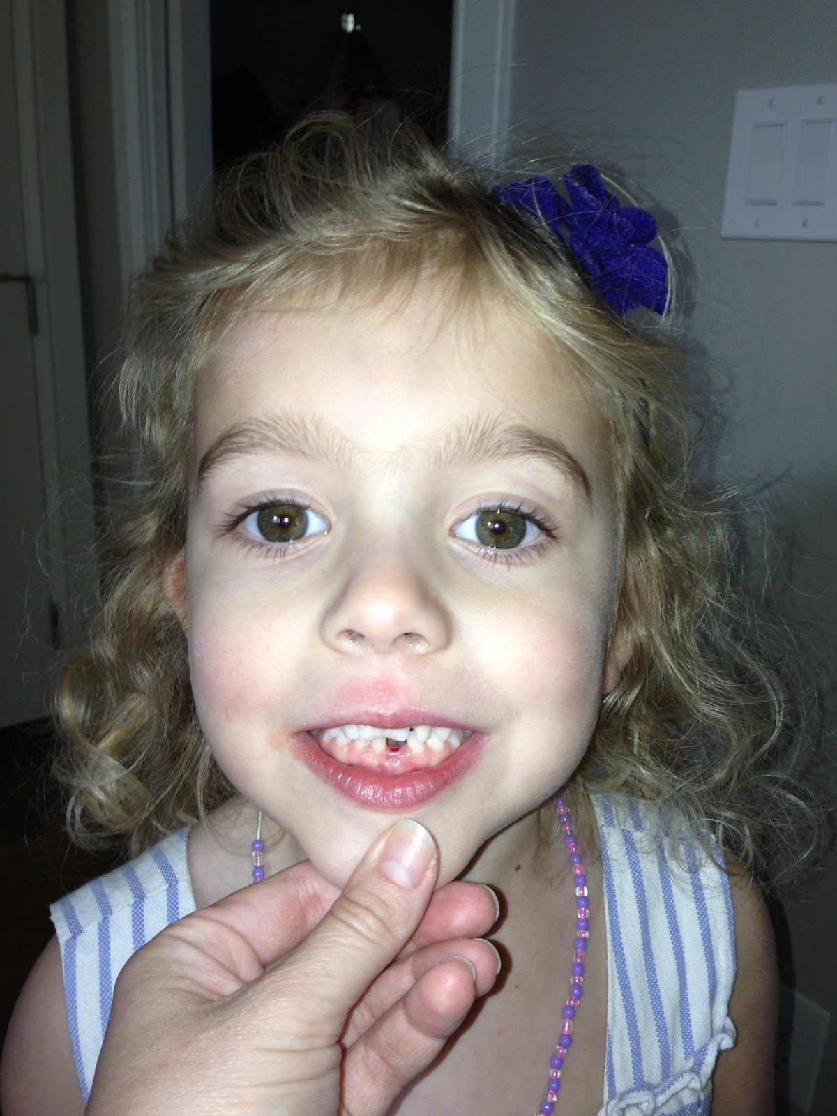 The Krauss Family "There's a hole in my mouth!"