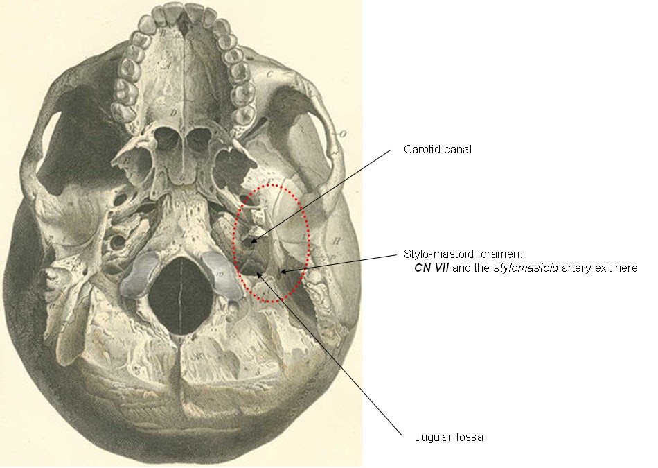 Skull and Spine Eagle syndrome