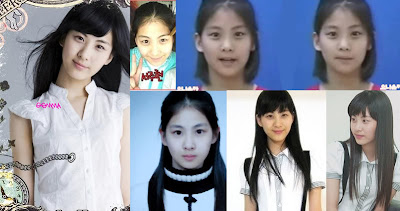 SNSD Seohyun Operasi Plastik Anggota SNSD Operasi Plastik, Benarkah?
