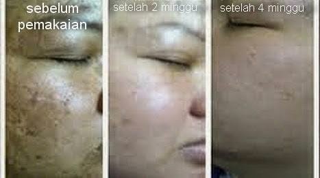 sumber berita dan informasi bio spray gold rp 80 000 sumber berita dan informasi bio spray gold rp 80 000