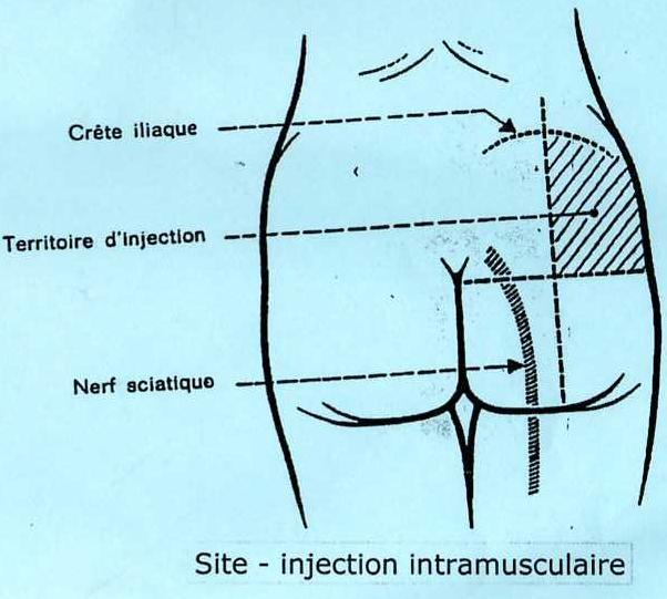 site-injection-intramusculaire.jpg
