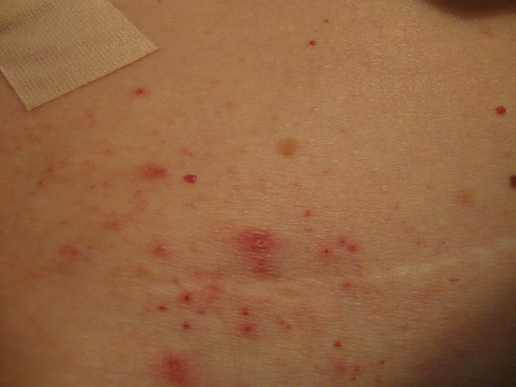 Study Medical Photos A 37 Year Old Woman Comes For An Evaluation Of