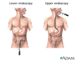 Jenis dan Fungsi Alat-alat Kedokteran - Endoscopy Jenis dan Fungsi Alat-alat Kedokteran - Endoscopy