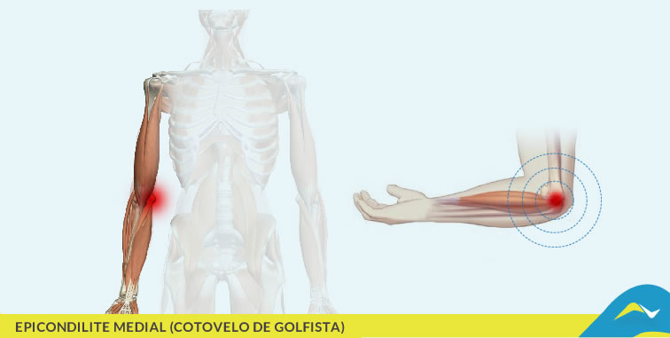 Tratamento de dores e doenças articulares