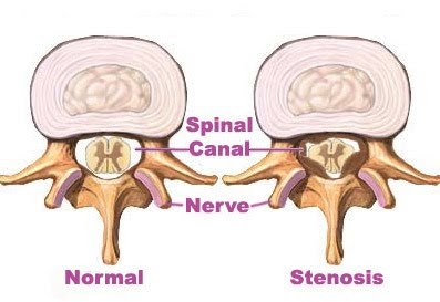 What Is Spine