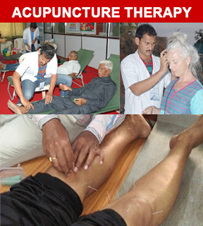 Acupuncture Nadipathy