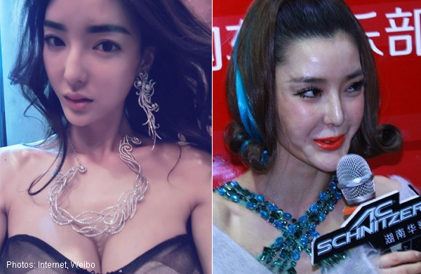 Li Zhi Ying sebelum dan sesudah oplas