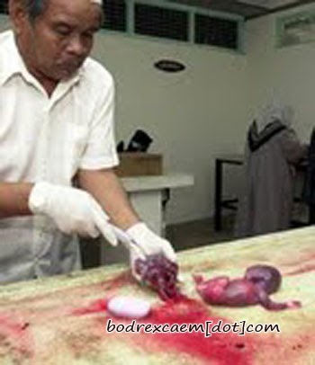 FOTO FOTO JANIN HASIL ABORSI [NGERI] - Thina Holmes Blog