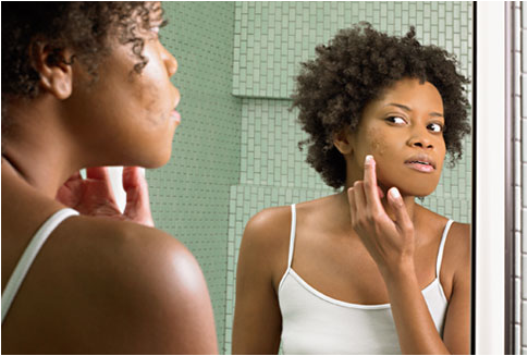Black woman with skin problem