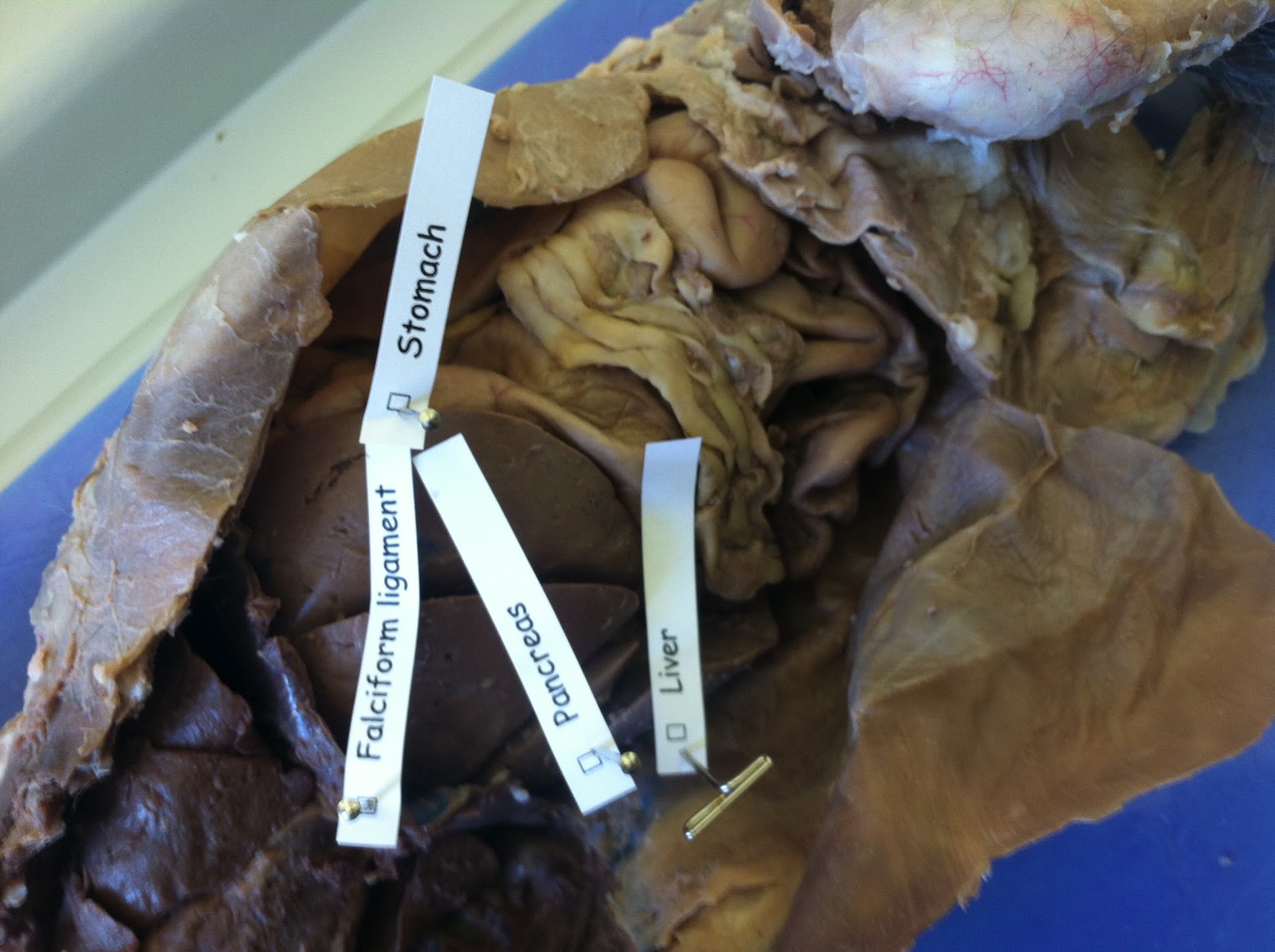 Cat Dissection: Human Anatomy: Digestive System