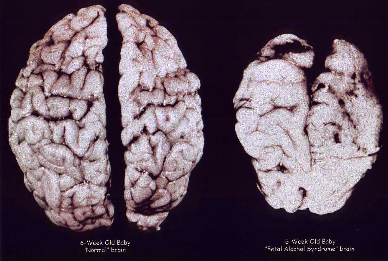 Brain Is The Conscience & GPS In Life Brain Is The Conscience & GPS In Life