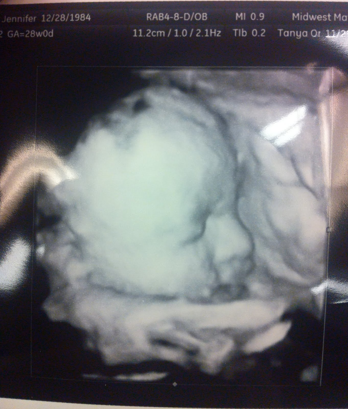 List 104+ Pictures What Does A 28 Week Fetus Look Like Sharp