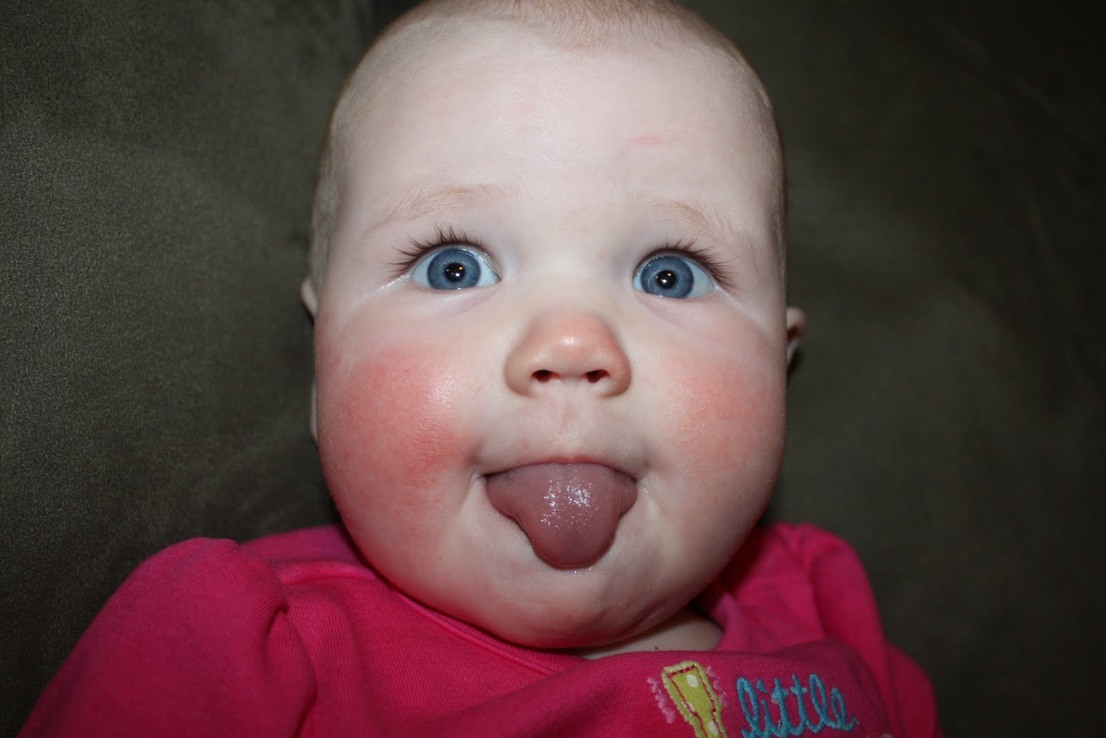 Baby Drool Rash Cheeks Get More Anythink's
