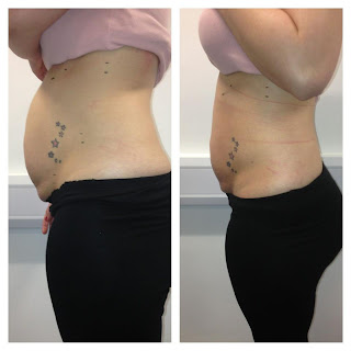 it works dfw body works body works wraps
