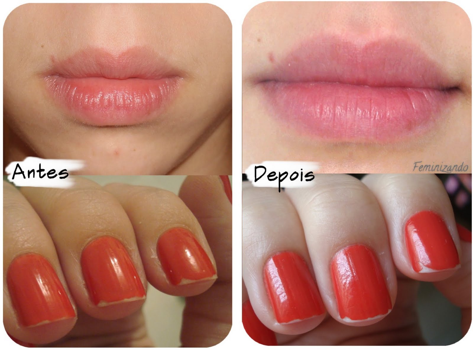 receitas de beleza: Bepantol