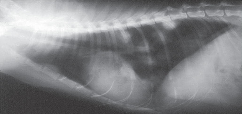 Hình 3: X-Ray xác định dịch hạch thể phổi