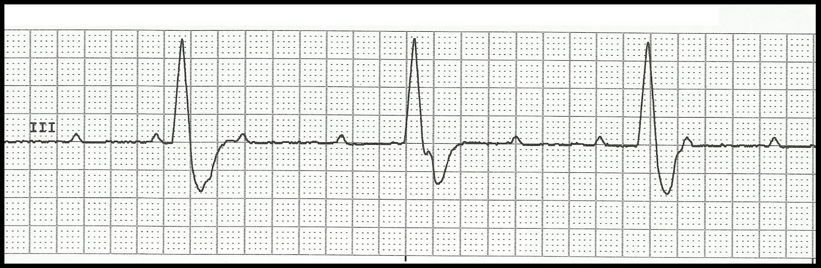Diagram Of Heart Answers