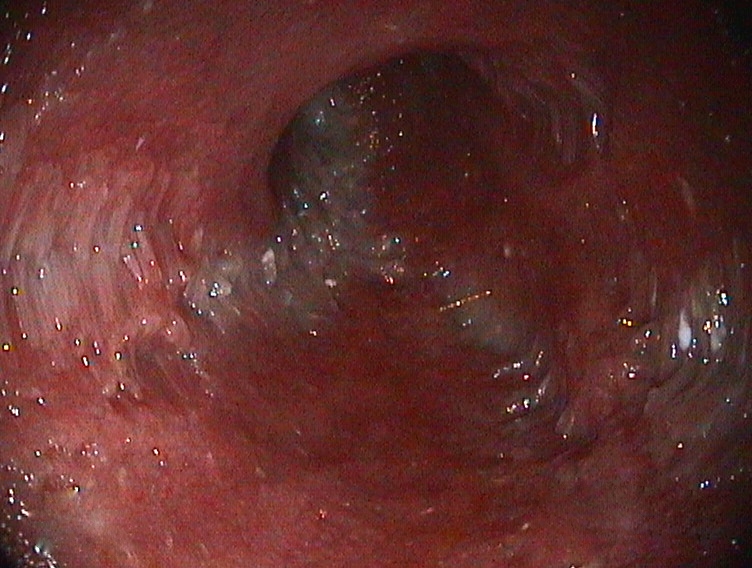 Enteritis en un perro. Enteroscopia Cirugía endoscopia veterinaria móvil