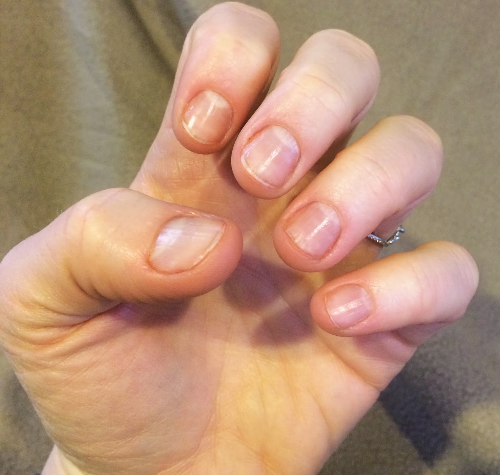 The ugly nail project - week 1 update.