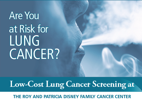 No association between lung cancer risk in women and reproductive history or hormone use