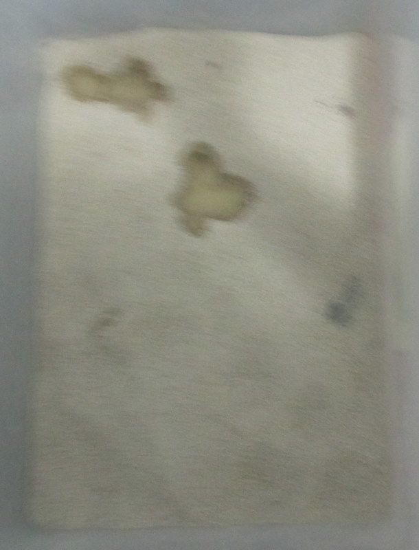 Irritated Urethra