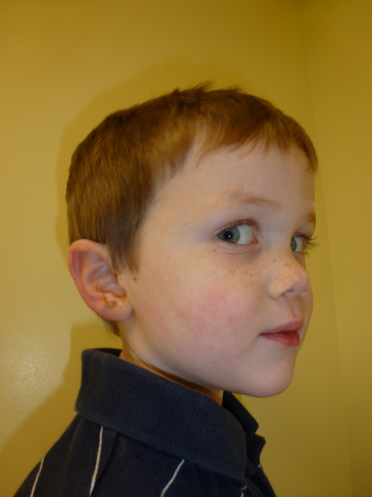 Say What? Ear Goop and Hives