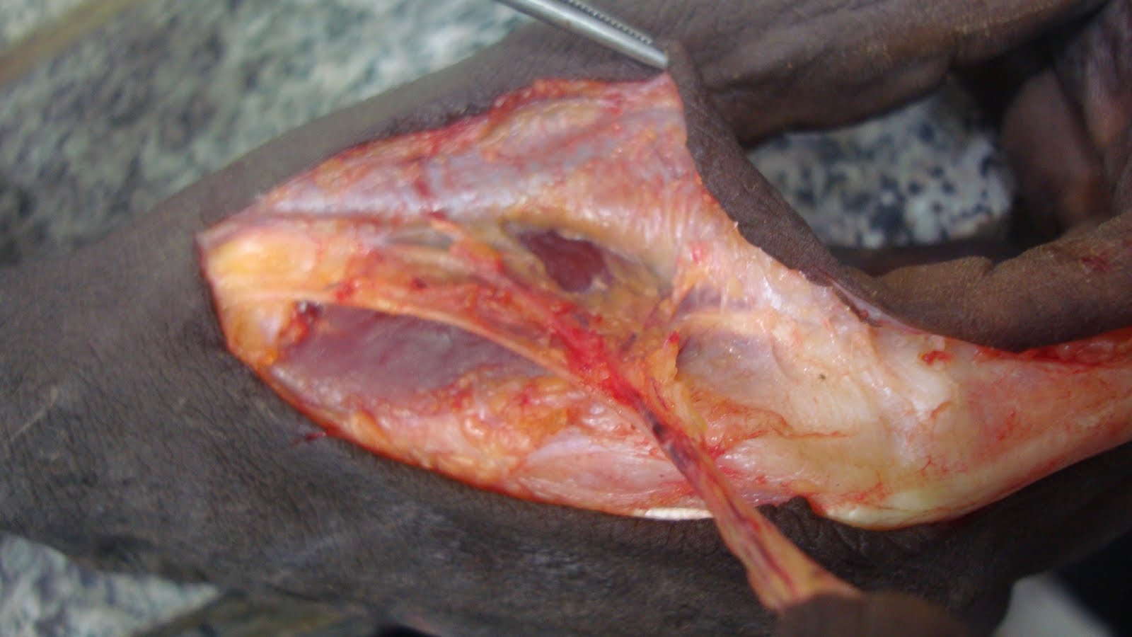 Dorsal Metacarpal Artery