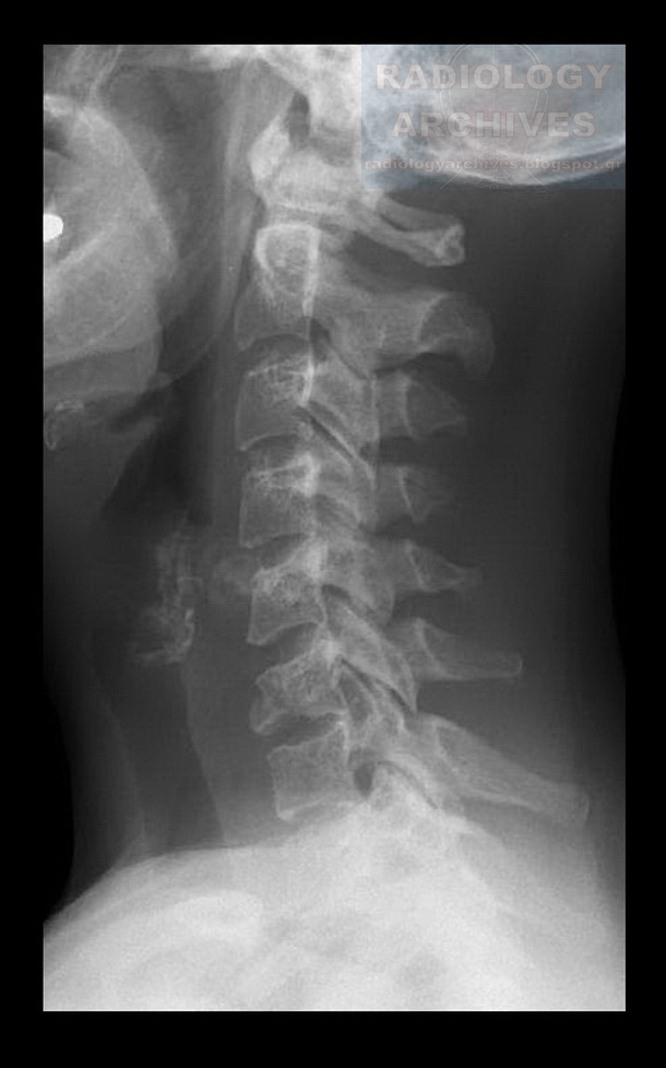 Radiology Archives Φεβρουαρίου 2013