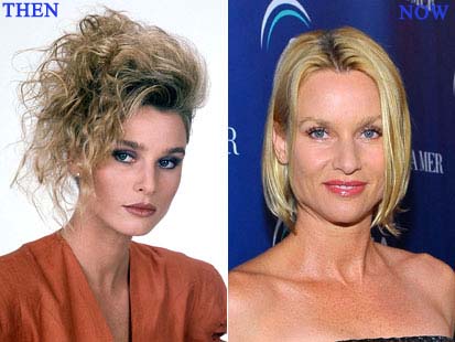 Nicollette Sheridan Plastic Surgery Before and After Breast Implants
