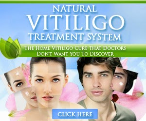 Natural Vitiligo Treatment System 
