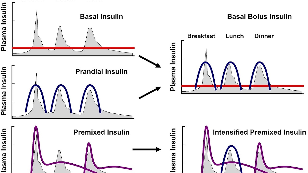 Bolus Insulin Definition Insulin Choices
