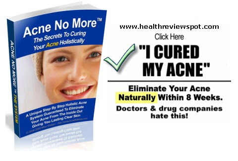 Anti Androgen Acne Natural Diet