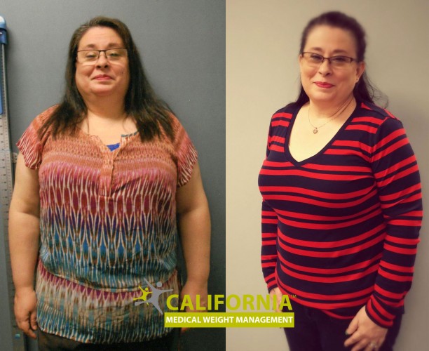 Amarillo, TX Center for Weight Loss California Medical Weight