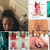 Cara Ampuh Mengobati Wasir (Ambeien) thumbnail